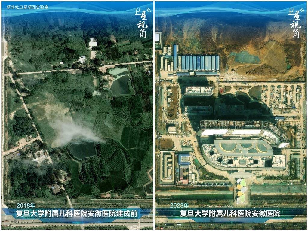 2023年與2018年相比，復(fù)旦大學(xué)附屬兒科醫(yī)院安徽醫(yī)院從一片荒地到建成投用。該項(xiàng)目是安徽省在長三角一體化高質(zhì)量發(fā)展衛(wèi)生健康領(lǐng)域的重大項(xiàng)目，也是安徽首批落地的國家區(qū)域醫(yī)療中心。